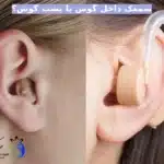 سمعک داخل گوشی بهتر است یا پشت گوشی؟