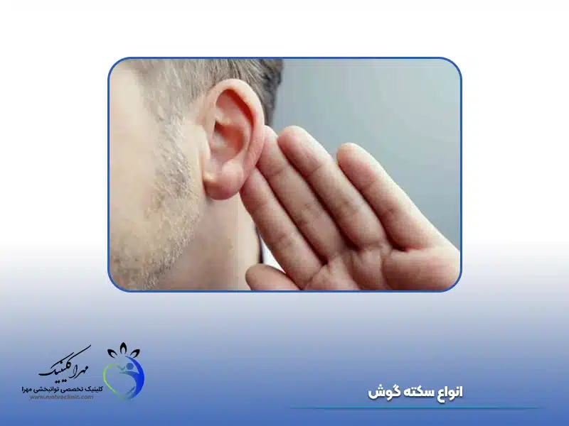 انواع سکته گوش