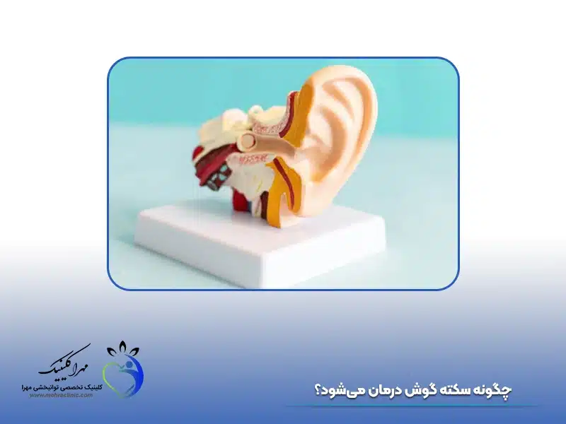 چگونه سکته گوش درمان می‌شود؟