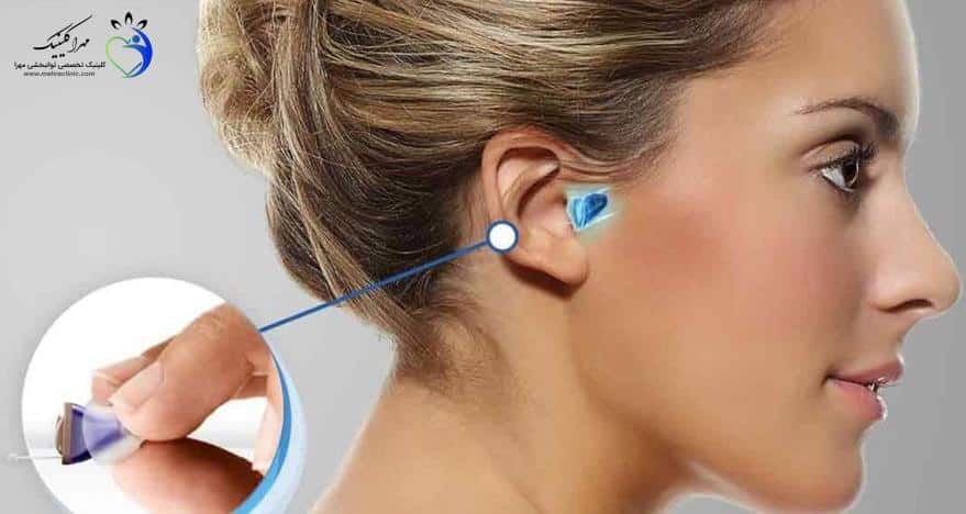 عوارض استفاده نکردن از سمعک، عواقب نزدن سمعک