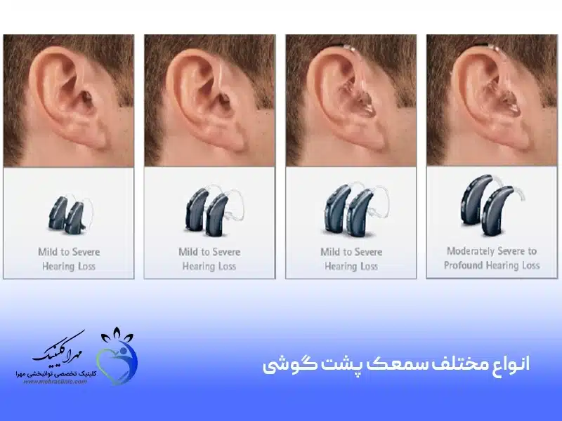 انواع مختلف سمعک پشت گوشی