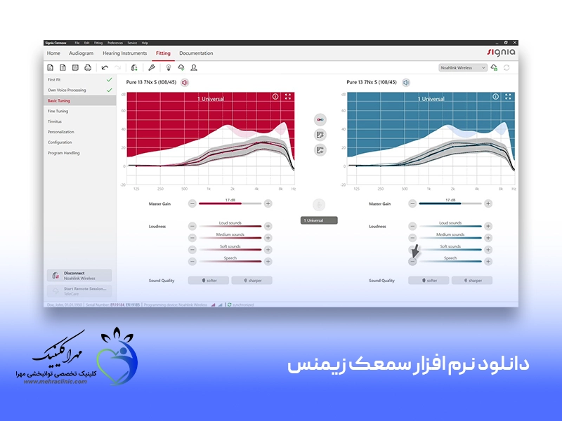 دانلود نرم افزار سمعک زیمنس