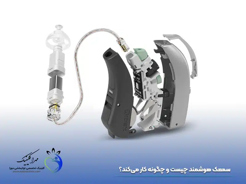 سمعک هوشمند چیست