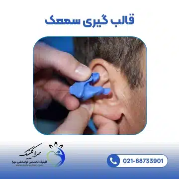 قالب گیری سمعک