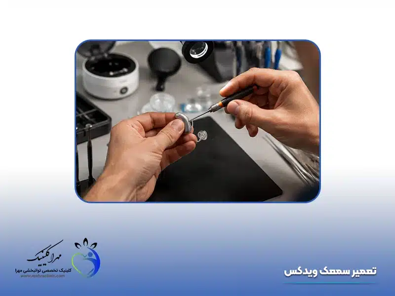 تعمیر سمعک ویدکس