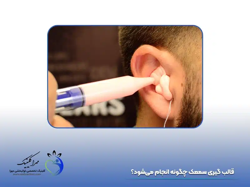 قالب گیری سمعک چگونه انجام می‌شود؟