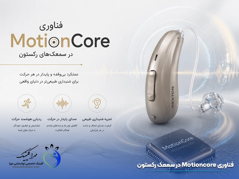 فناوری Motioncore در سمعک رکستون
