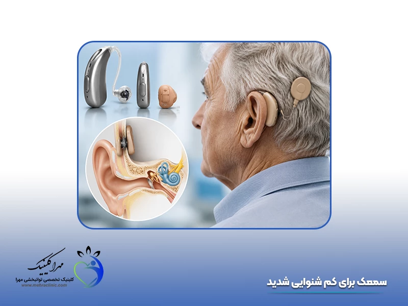سمعک برای کم شنوایی شدید