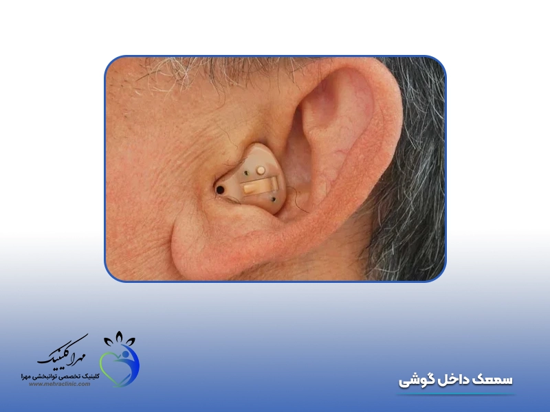 انواع سمعک: 2. سمعک داخل گوشی (ITE)