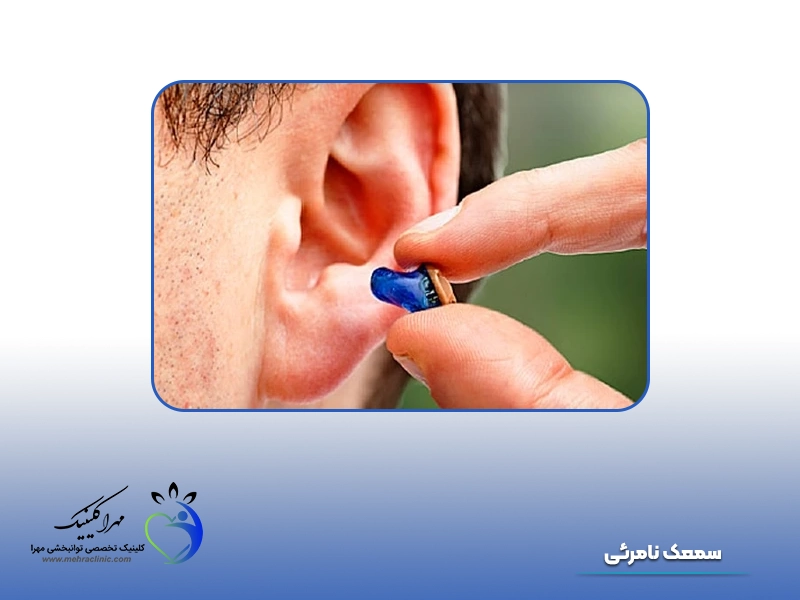انواع سمعک: 1. سمعک نامرئی