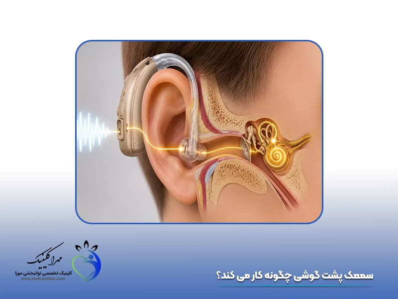 سمعک پشت گوشی چگونه کار می‌ کند؟