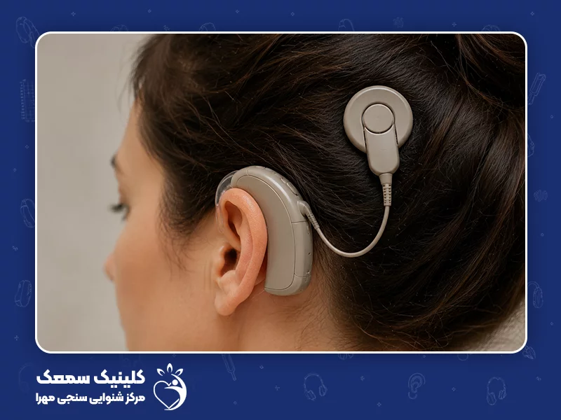 بهترین روش درمان وزوز گوش: 16. کاشت حلزونی
